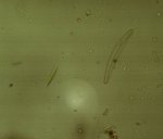Rhizosolenia u. Cymbella sp..jpg