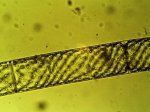 Spirogyra m. Zellkern rr.jpg