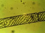 Spirogyra m. Zellkernen rr.jpg