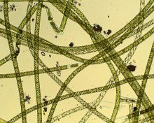 Spirogyra3 kleiner Teich.jpg